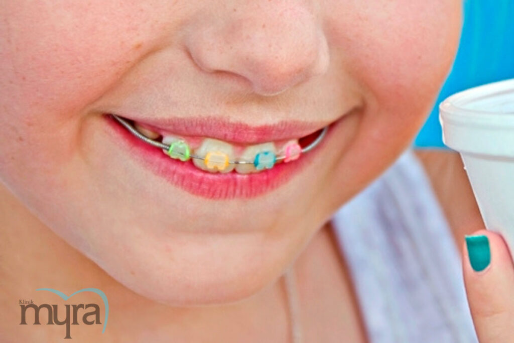 , Çocuklarda Ortodonti Tedavisi